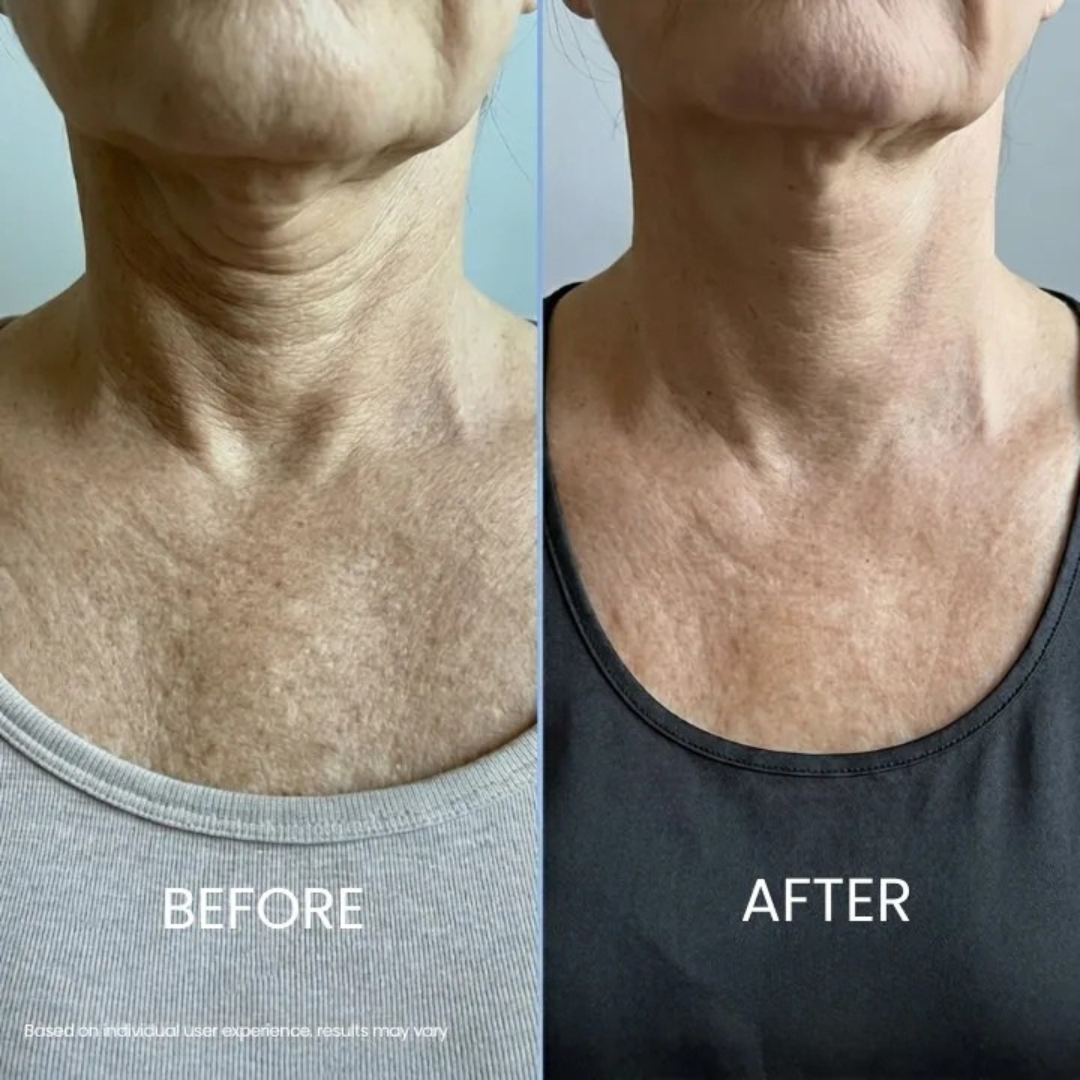 Elastyn® Tighten & Lift Neck Cream